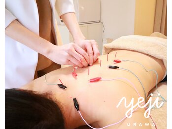 イエジ 浦和(Yeji)/◆鍼灸◆頑固な肩こりに