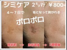 エステ ルーナ 学園前の雰囲気（【シミケア２ミリ迄￥800-】【シミケア15分/30分取り放題】）