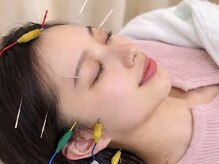 ひびき鍼灸院 整骨院