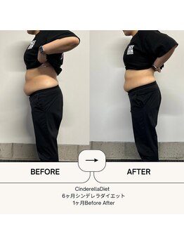 オーシャン整骨院(OCEAN整骨院)/６ヶ月コース