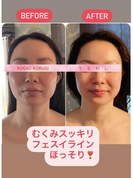 ウルワシ(Uruwashi)/★ビフォーアフター★