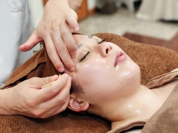 はりキュア(はりCure)/美容鍼 美モッチ（べるもっち）