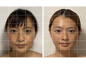 サロン アモル(salon amor)の写真/【当店おすすめの脳洗浄★】話題の脳洗浄で頭スッキリ♪小顔効果も期待◎専門施術で脳疲労リフレッシュ！