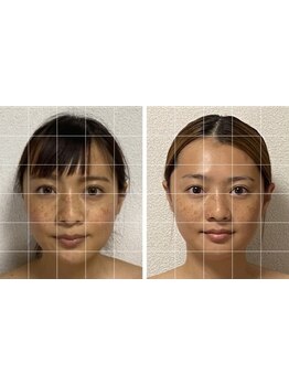 ヘッドスパで癒されたい