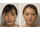 サロン アモル(salon amor)の写真/【当店おすすめの脳洗浄★】話題の脳洗浄で頭スッキリ♪小顔効果も期待◎専門施術で脳疲労リフレッシュ！