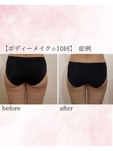 ソワイユ 浜松店(Soyeux)/ボディーメイク　before→after