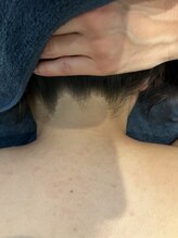 ソイ(soi)/うなじも整えます！