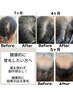 【月曜限定 祝日〇】違いを実感／結果が分かる育毛促進ヘッドスパ60分
