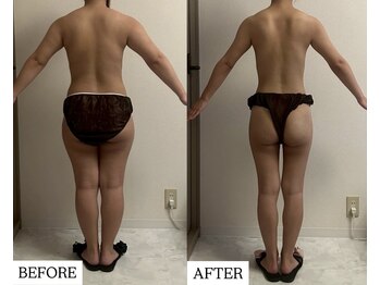 フェミニー(Feminy)/下半身痩せ