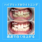 シャイニング 岩出店(SHINING)