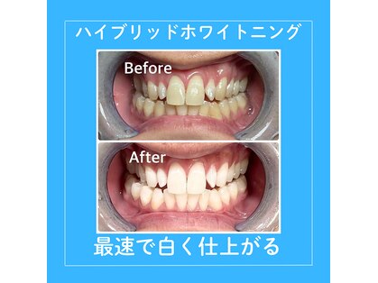 シャイニング 岩出店(SHINING)の写真