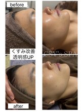 ヘルスアンドビューティー シーズスパ(CSY's SPA)/ダクトピール