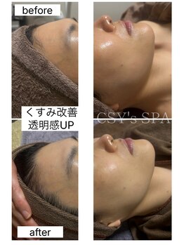ヘルスアンドビューティー シーズスパ(CSY's SPA)/ダクトピール