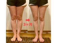 サロンアール(SALON R)の雰囲気(3ヶ月で見た目も変化・持続◎むくみ改善は"下半身痩せの第一歩")