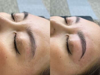 ブリエ(Briller)/ハリウッドブロウリフト