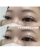 レディエント(Radiant)/フラットラッシュ140本