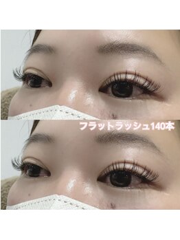 レディエント(Radiant)/フラットラッシュ140本