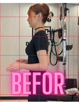 オーダーメイズ/施術前写真