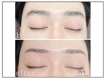 アイビー(IVY)/自己処理も簡単に