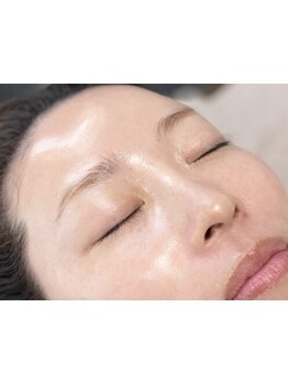 ホウレイ線・たるみ改善！予防ケア