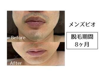 メンズビオ 神戸三宮店/