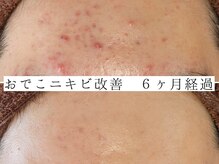 ユウビジン(YOU美人)/