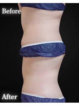 サンティエ(Santie)/ポッコリお腹撃退◎