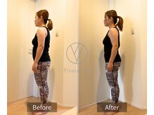 アイユー 大久保店(Pilates iU)/ピラティス　Before&After