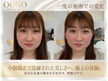 おおの鍼灸接骨院