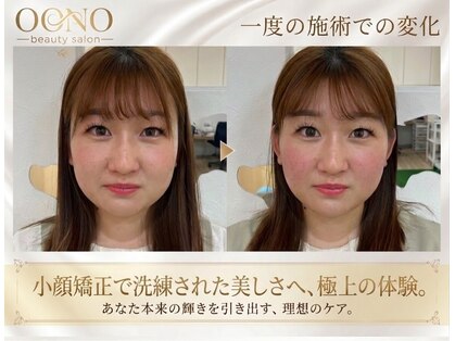 おおの鍼灸接骨院の写真