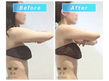 ドクタービセア 池袋店(DR.VISEA)/充実痩身で健康的に変われる