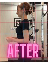 オーダーメイズ/施術後写真