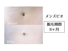 メンズビオ 神戸三宮店/