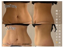 ダリアビューティーアンドピラティス 麻布十番(Daria beauty & pilates)の雰囲気（【驚愕の結果】最強痩身機器4種で最短痩せ叶えます！[麻布十番]）