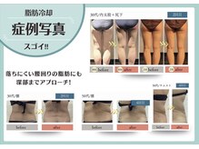 ルミナス/症例写真！！