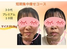 ヨサパーク リボーン(YOSA PARK Reborn)/劇的ビフォーアフター/痩身駒込