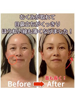 ラヴィフルリル(Ravi FleuRir)/小顔矯正ヘッドスパの変化