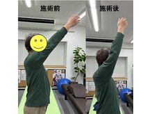 コウジュウドウプラス(耕揉堂Plus+)/肩挙上時の引っ掛かりを軽減２