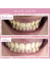 エクシアホワイト 長野店/