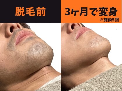 モイ(moi)の写真