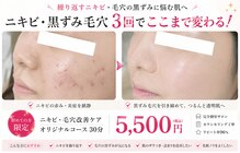 ビジュー(Bijou)