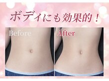 リフト 高田馬場(Lift)の雰囲気（小顔・脂肪燃焼に特化＊マイクロウェーブ【小顔/高田馬場/痩身】）