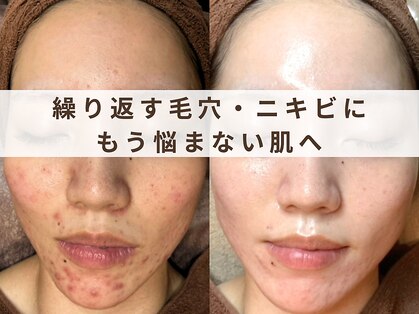 スイ(Suui.)の写真