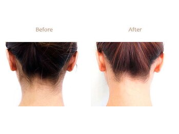 ビューティフェイス ビューティアイラッシュ 岡山天満屋店(BeautyFace Beautyeyelash)/襟深ぞり￥2200【岡山】【表町】