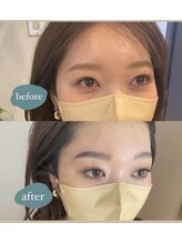 エールバイボヌール(Ere by Bonheur)/hollywood brow lift 