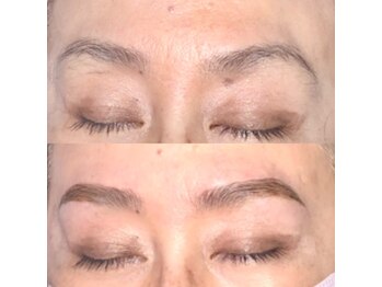 ヴィプラス(Vi+)/