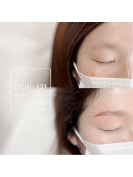 リヨン(LYON+831)/Hollywoodbrowlift