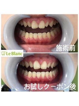 ルブラン 奈良店(Le Blanc)/高校生のお客様も!