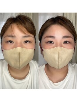 アンドミー(&me)/HBL×オーダーメイドリフト