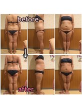 アンリール 旭川店(Anrire)/BODY施術のお客様です！